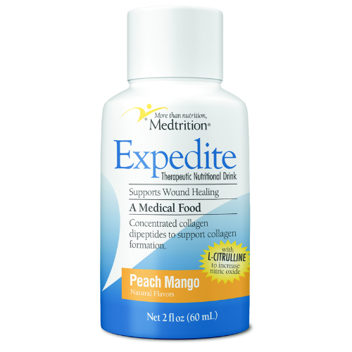 Expedite™