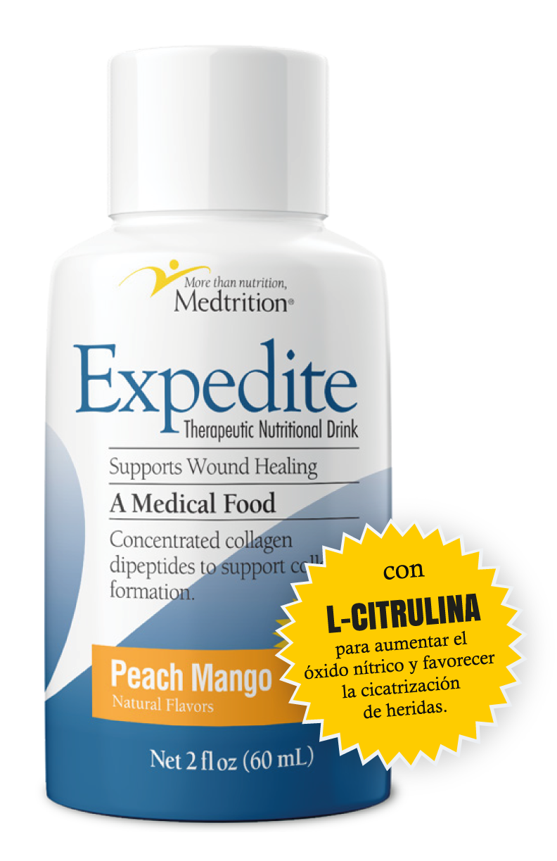 Expedite